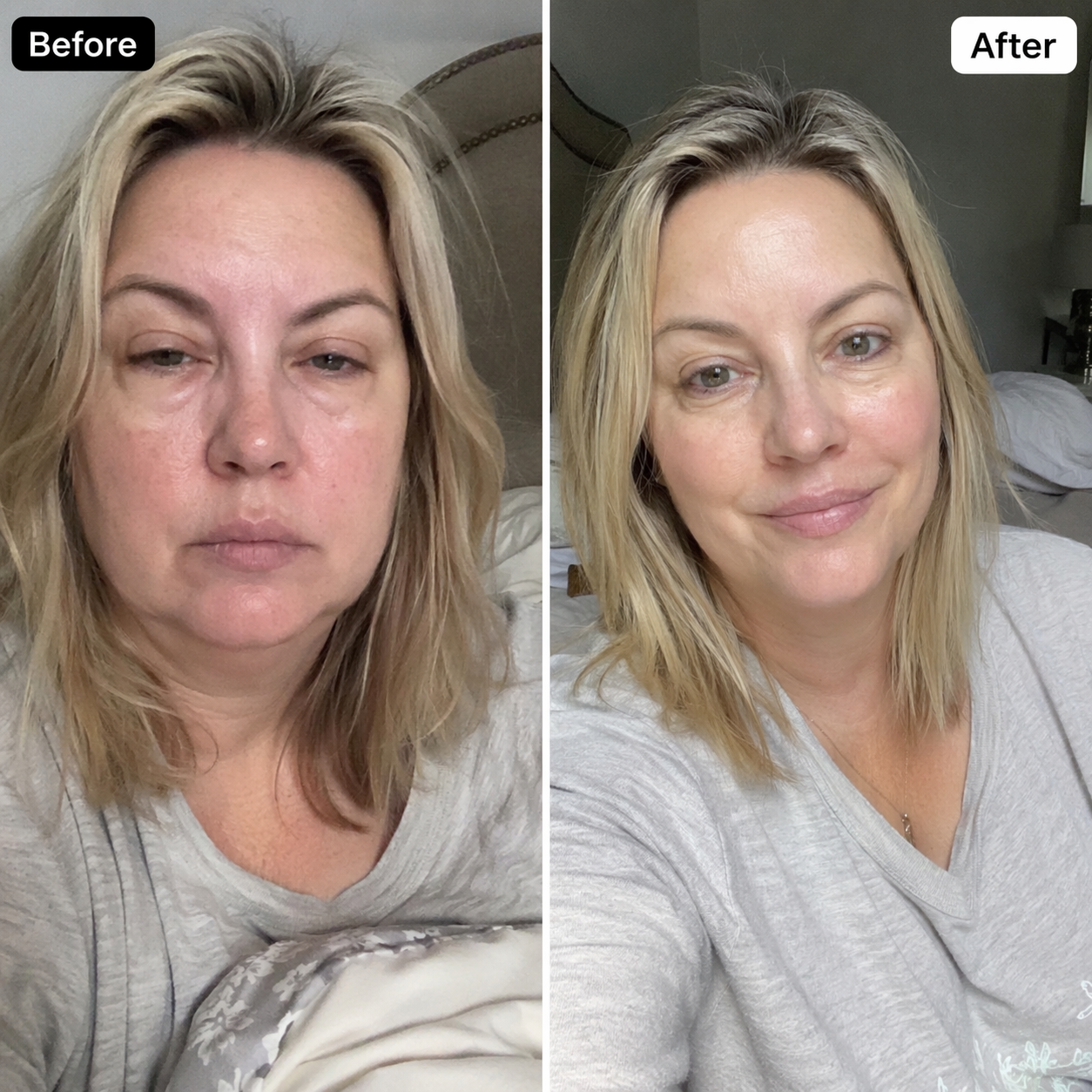 Lymphatic Drainage Capsules